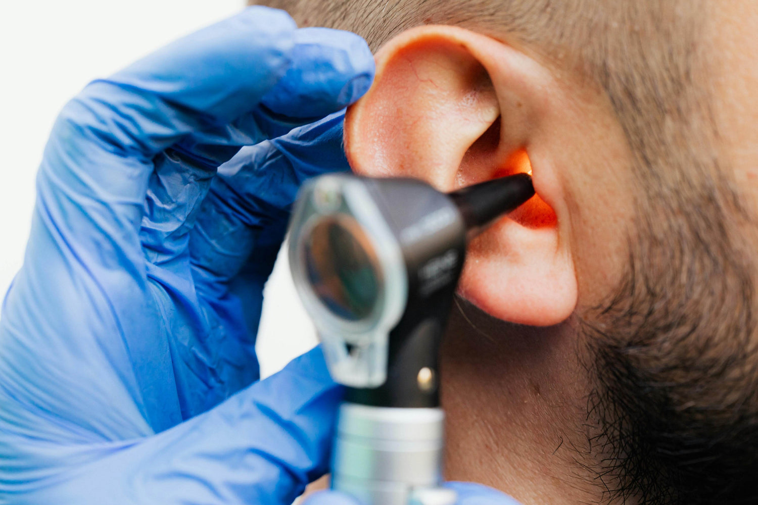 Otoscope Cameras - P12 Hub Europe